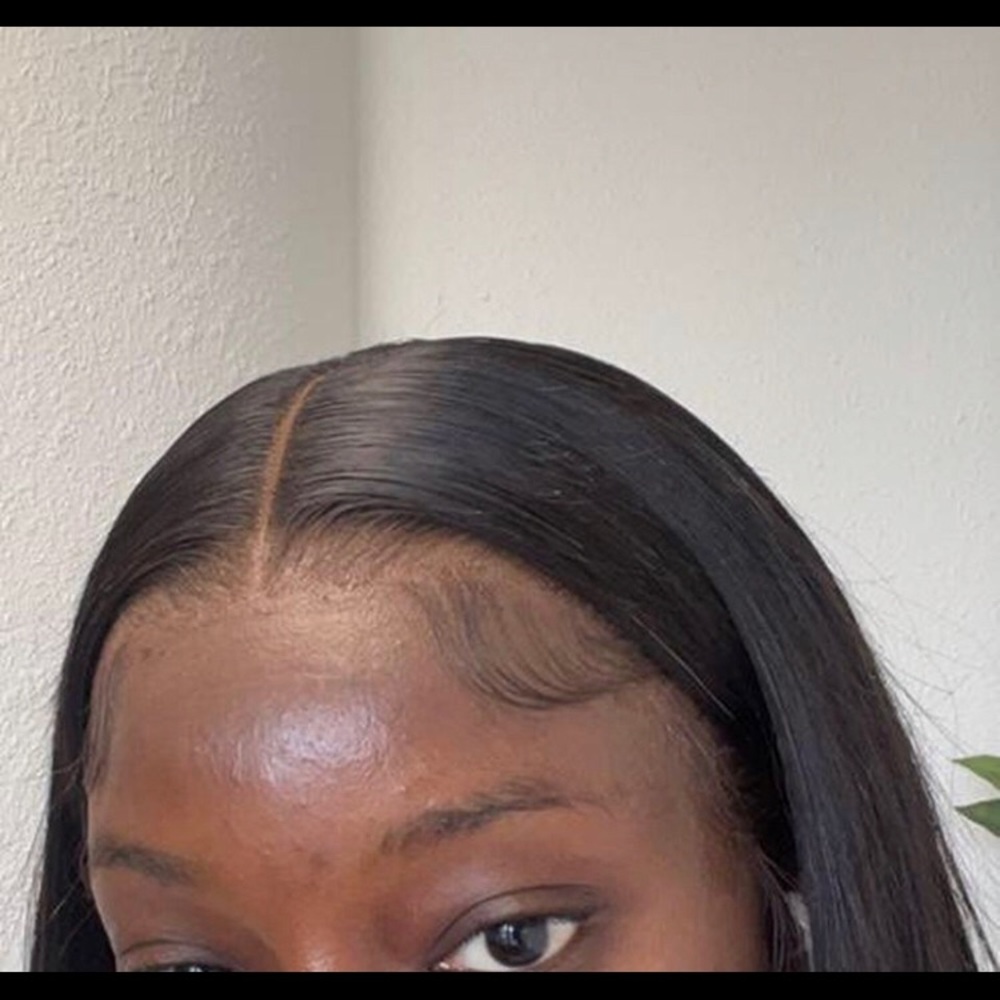 Frontal wig